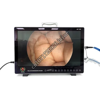Медицинский видеоэндоскоп Full HD, ЛОР-лапароскопическая вышка Sinuscope, портативная эндоскопическая система со встроенным рекордером